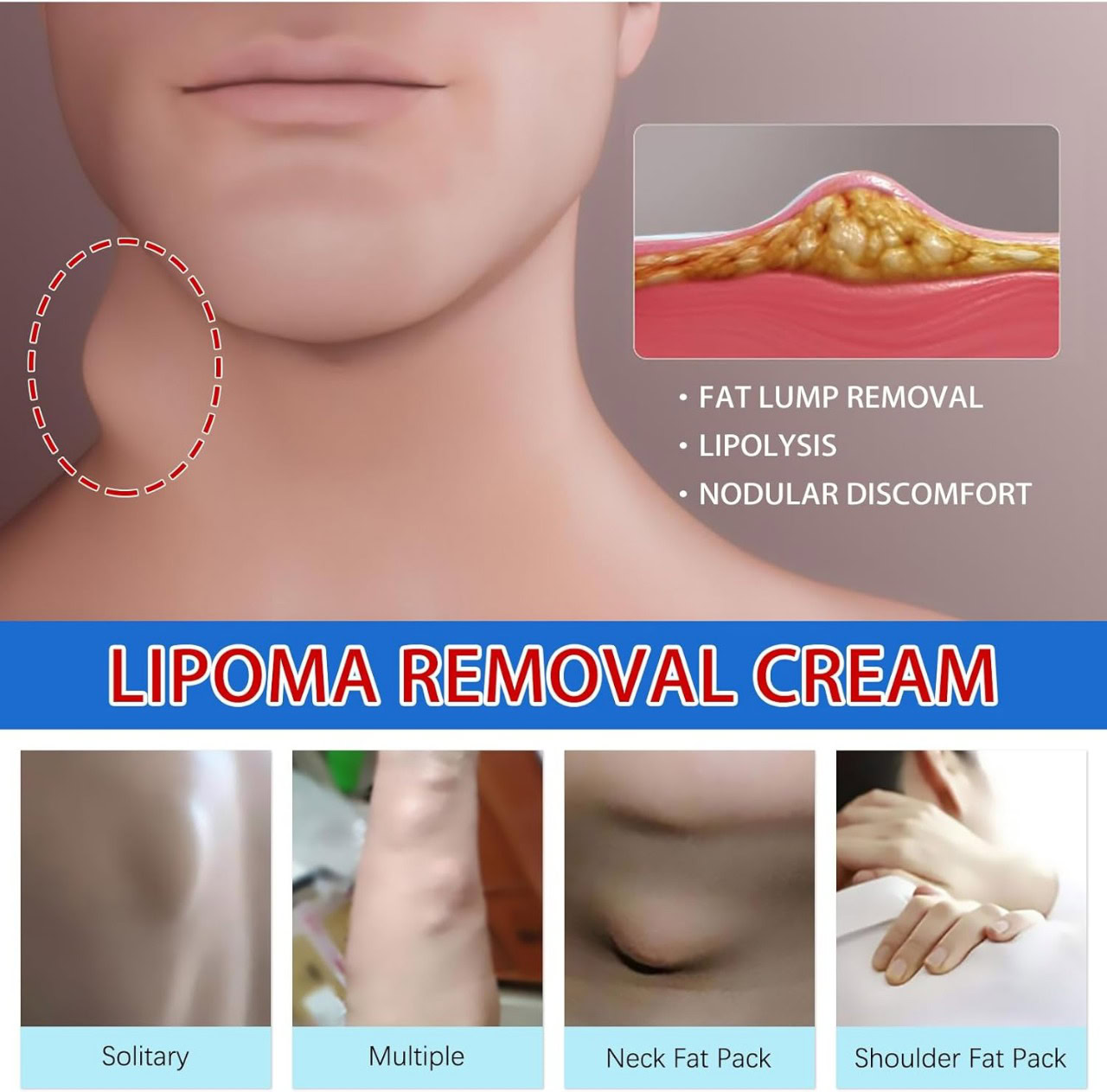Daddychinashop, lipoma removal cream for fat lump reduction and pain relief, featuring natural ingredients.