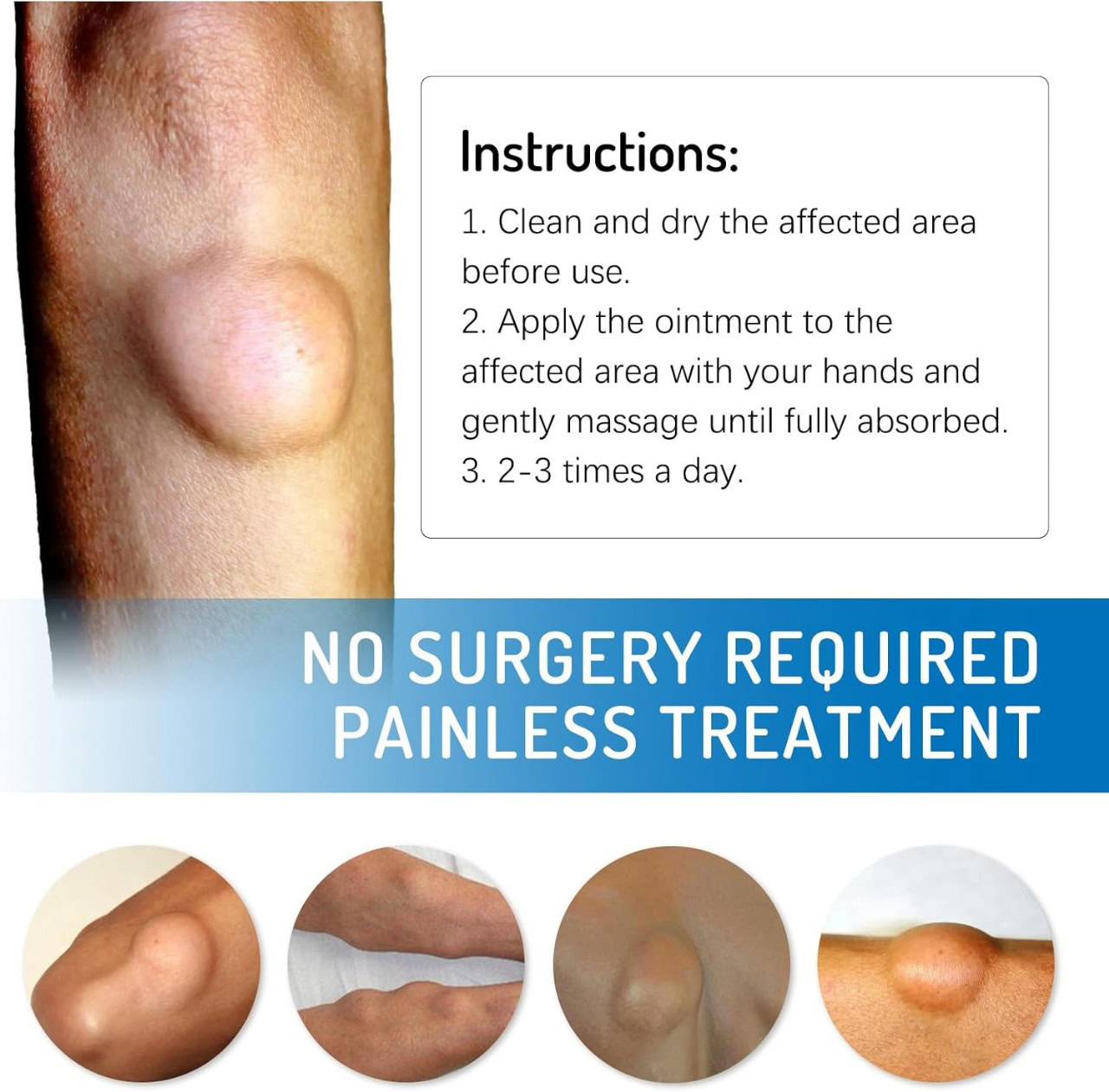 Red bump on skin for skincare treatment.